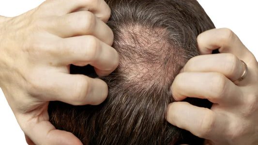 The Link Between Stress and Hair Loss: How to Break the Cycle